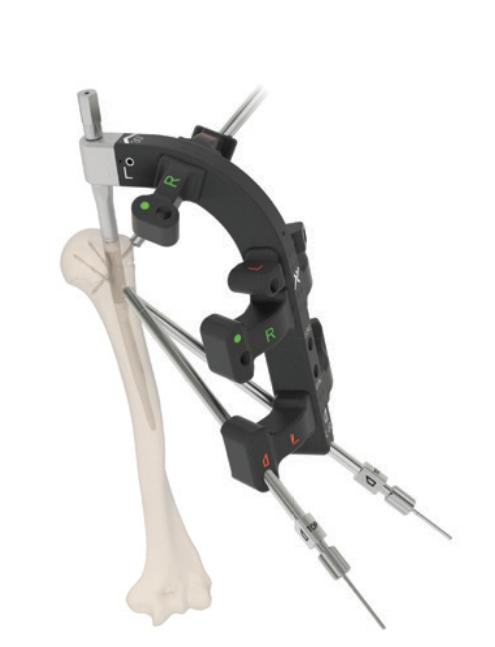 inline_801_https://www.legheleggere.com/wp-content/uploads/Medical-devices-two-component-humeral-nail-4.png
